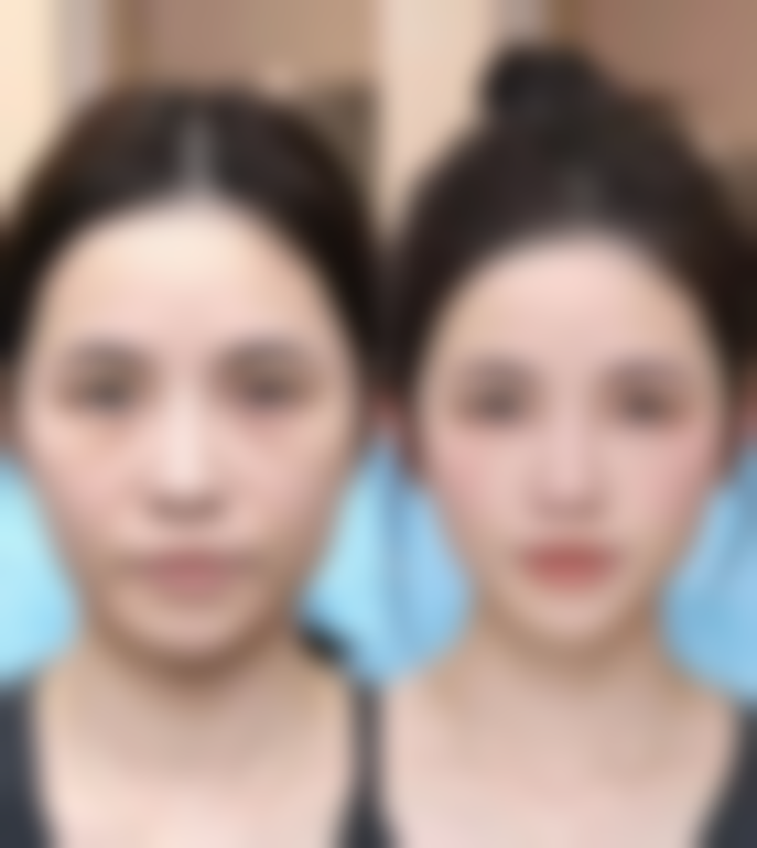 七、南通嘉佳美姿丽莱医疗美容门诊部预约挂号方式及流程