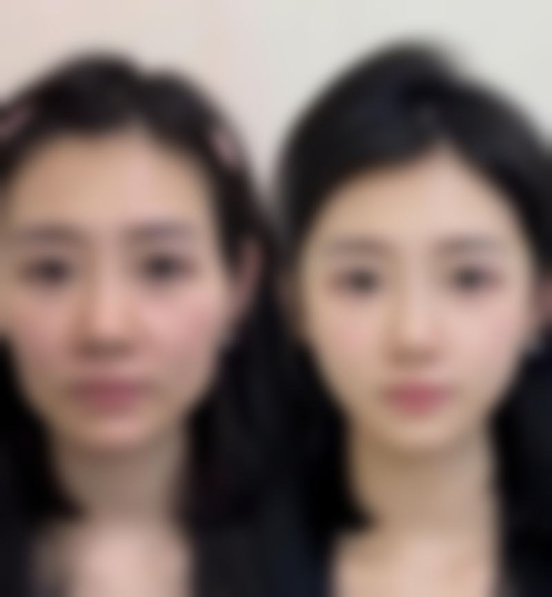 六、乳山奥美涵熙整形医院口碑怎么样