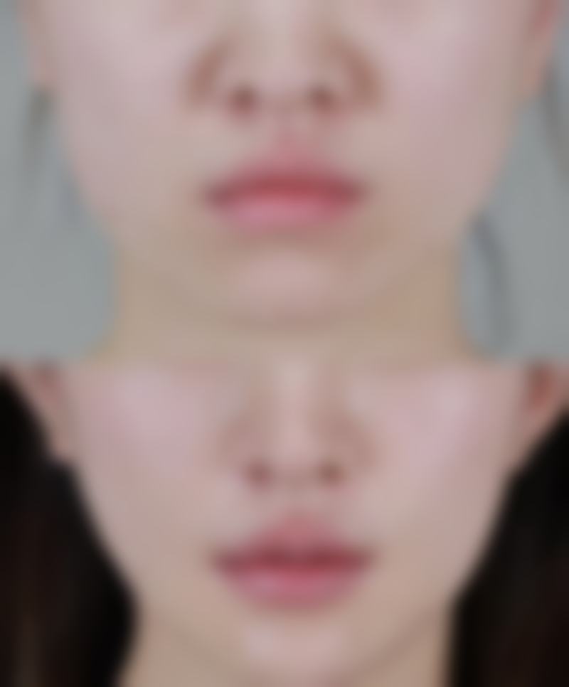 李東畇医生荣誉资质