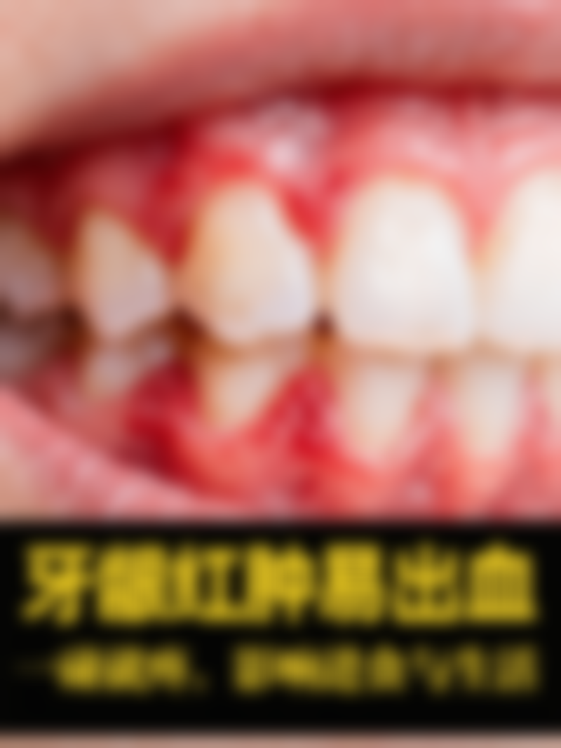 东营种植牙私立医院排名