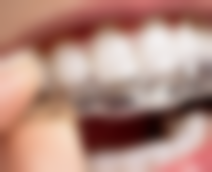 医生技术水平：经验多，补牙更快更准