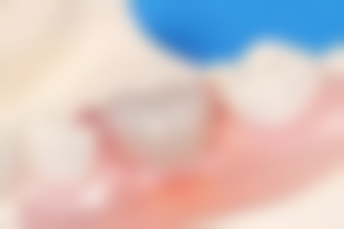 段红娇医生坐诊