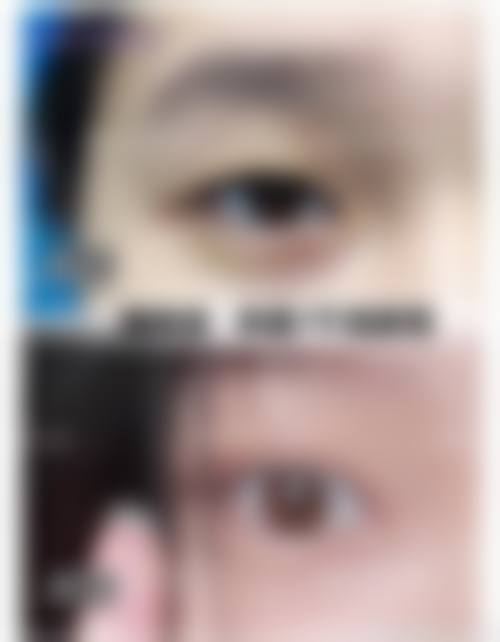 二、海南婕熹卡医疗美容门诊部是正规医院吗