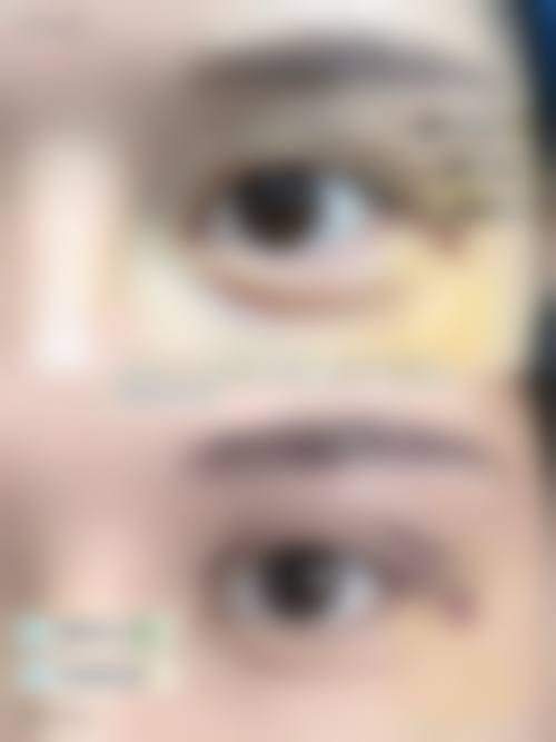 六、浙江温州诺拉整形收费价格表