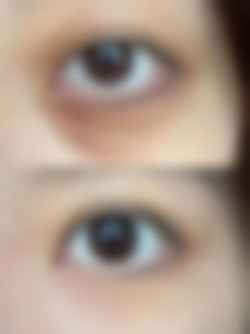 七、无锡伊美尔整形医院口碑怎么样？