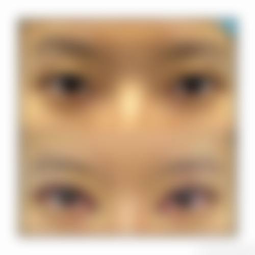 刘长松医生收费价格表