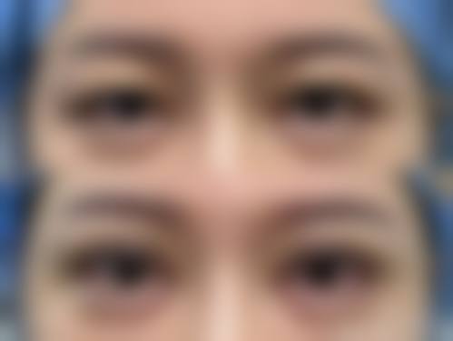 刘长松医生真人实例