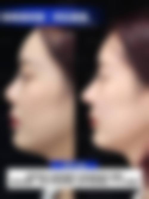 七、廊坊瑞美慧整形医疗美容医院口碑怎么样？