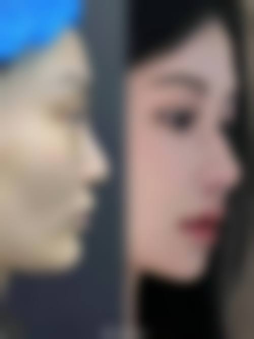 李禾德医生擅长项目