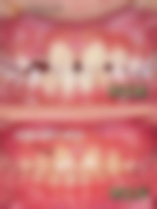 影像学检查：精细确定地包天程度的科学手段