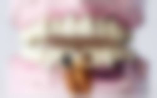 {丽水补牙在线咨询24小时：38元起树脂补牙，亮贝美客服随时答疑