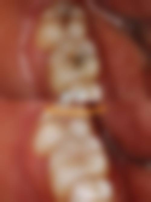 口腔项目价格透明