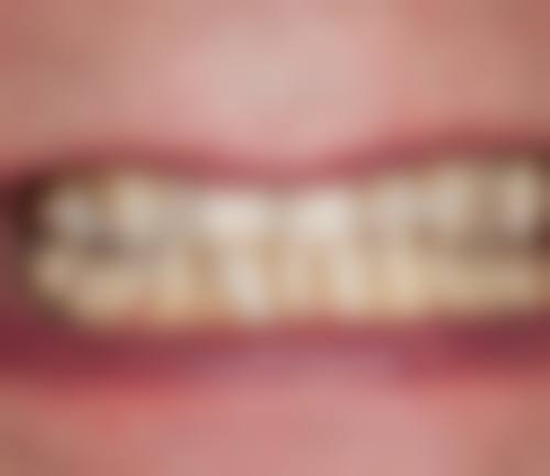 牙齿美白骨干医生团队