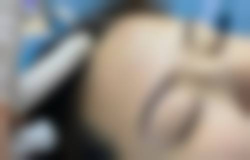 五、韩国HG医疗整形美容外科收费价格表