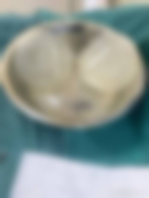 刘长松医生口碑评价