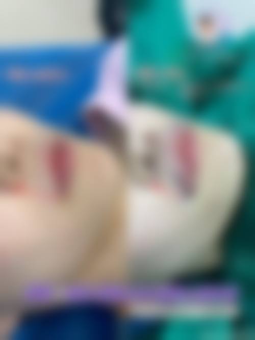 六、昆明珠玑医疗美容口碑怎么样？