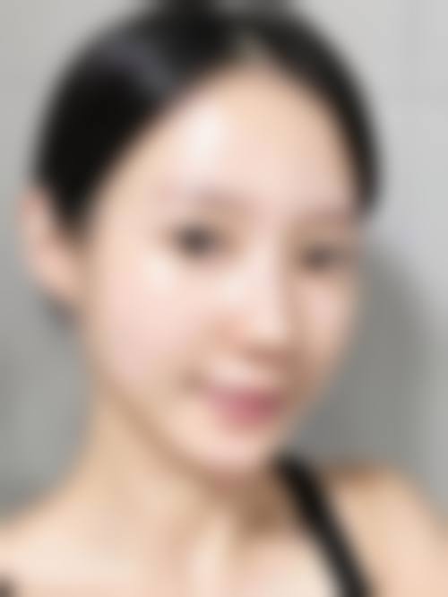 刘长松医生技术优势