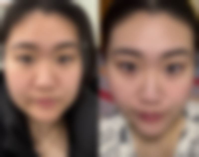 六、廊坊瑞美慧整形医疗美容医院收费价格表