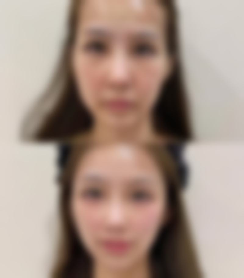 五、海南婕熹卡医疗美容门诊部收费价格表