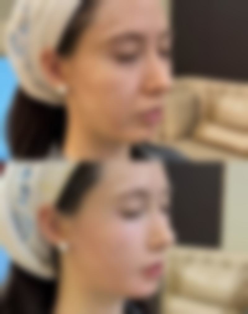 侯涛医生擅长项目