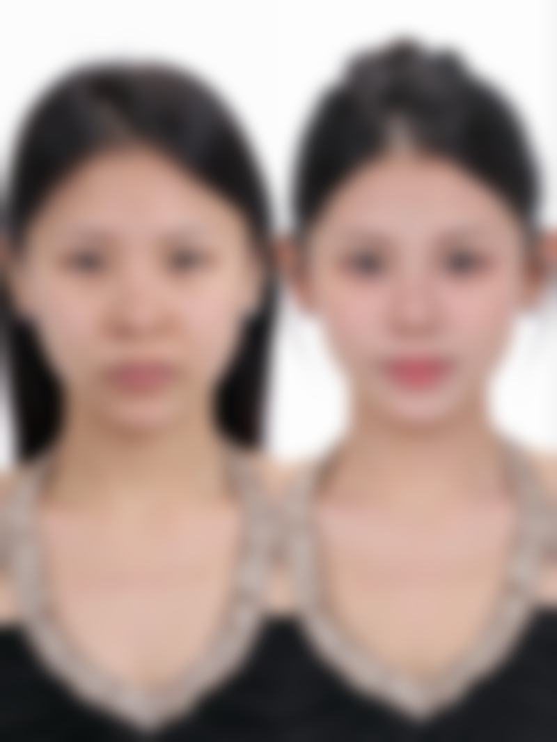 三、韩国HG医疗整形美容外科地址电话营业时间