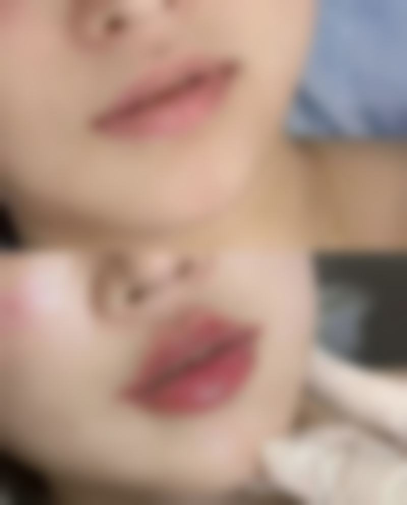 李禾德医生技术优势