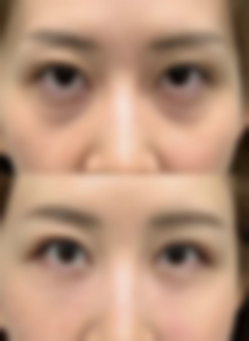 五、永康俞福进医疗美容诊所收费价格表