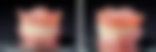 费用参考：各地补牙价格有别