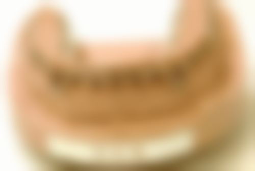 补牙材料：选择合适材料至关重要