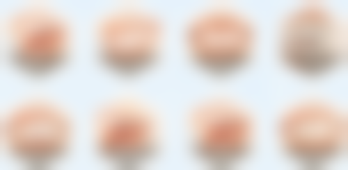 根管治疗:系统治疗牙齿根管的方法