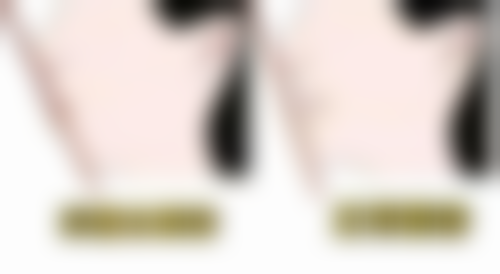 全瓷牙品牌的价格与性能对比