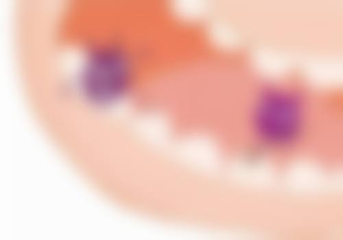 患牙位置：前后牙补牙时间有差异