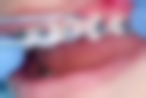 部分哈尔滨义齿医院介绍