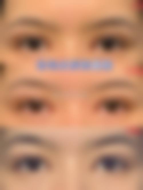 五、延安欧神美医疗美容门诊部收费价格表