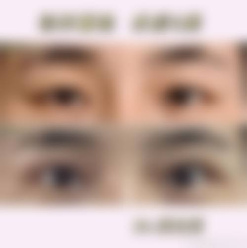 二、淄博张店德美医疗美容整形医院是正规医院吗