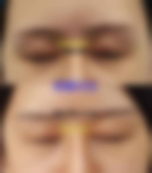 刘长松医生技术优势