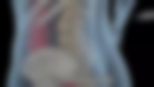 三、国内科学技术大学附属第一医院（安徽省立医院）(烧伤整形科)特色项目及技术优势