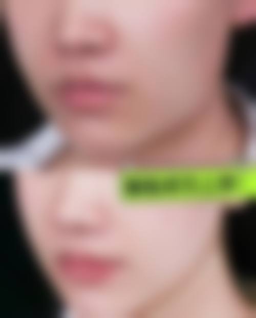 八、烟台铁路医院美容整形中 心预约挂号方式及流程