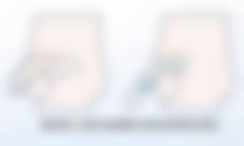 侯涛医生真人实例