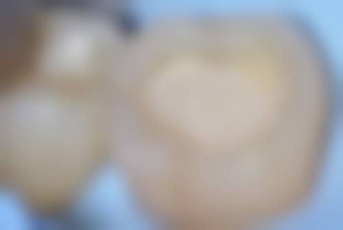 {安亭哪里看牙比较好？摩尔/华齿等连锁真靠谱，洗牙百元补牙两百起