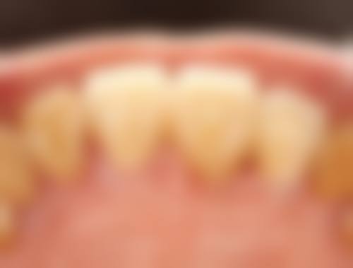 其他特色镶牙医院