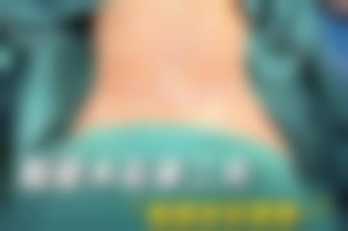 李禾德医生技术优势