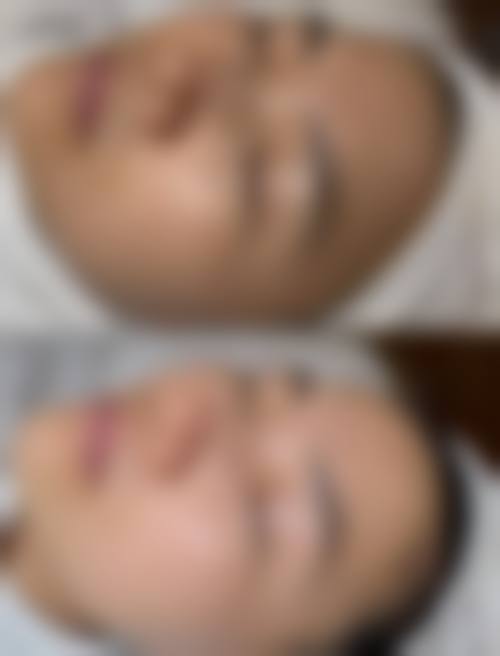 五、黄骅熙芝医疗美容诊所收费价格表