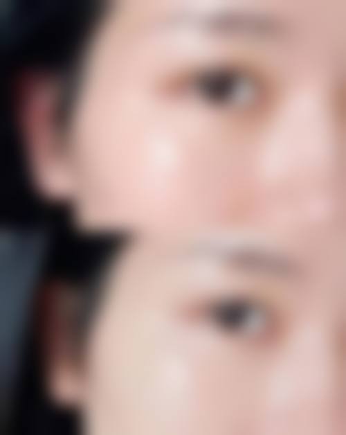 五、深圳广和整形美容门诊部收费价格表