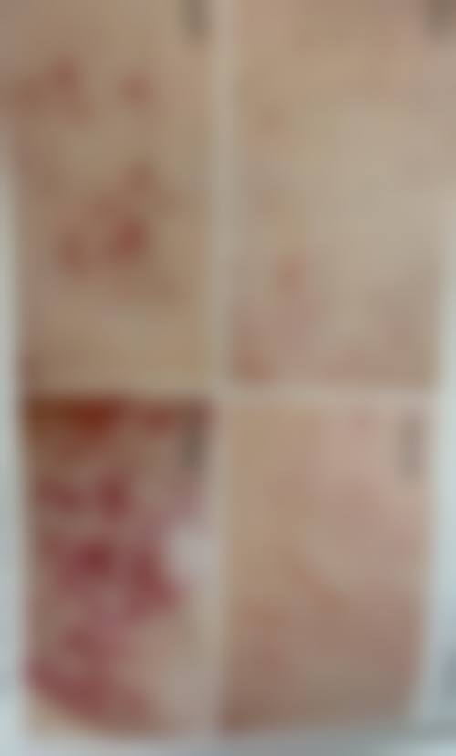 三、日照市中医医院整形美容与皮肤病科地址电话营业时间