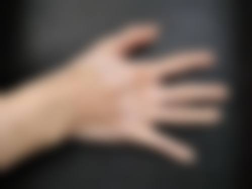 八、日照市中医医院整形美容与皮肤病科预约挂号方式及流程