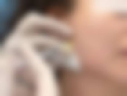 七、黄骅熙芝医疗美容诊所预约挂号方式及流程