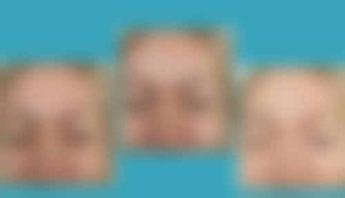 六、黄骅熙芝医疗美容诊所口碑怎么样?