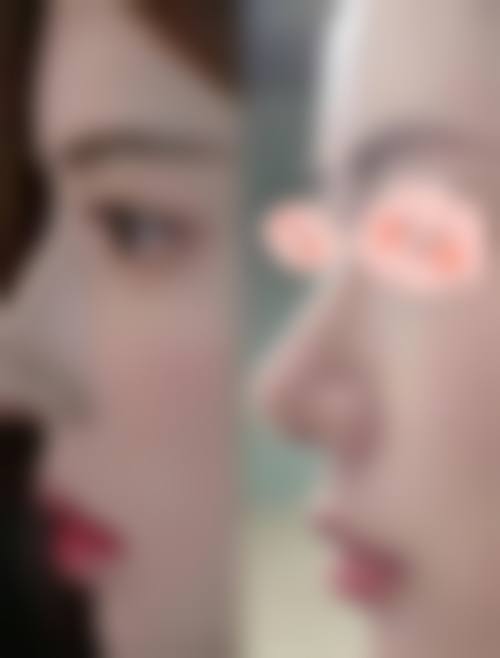 刘长松医生擅长项目