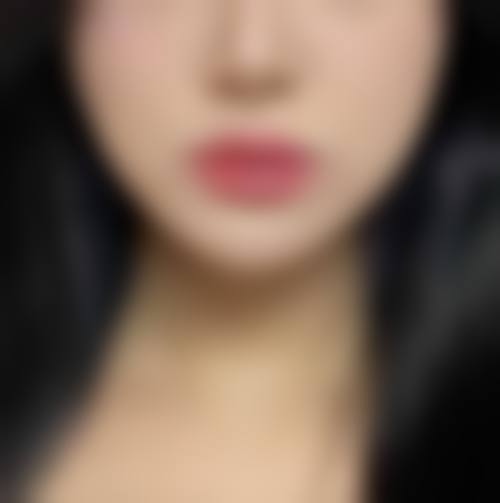 六、云南保山阳光医院口碑怎么样？